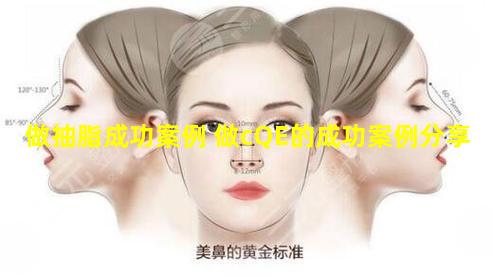 做抽脂成功案例 做cQE的成功案例分享